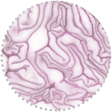 images/slider-layer1